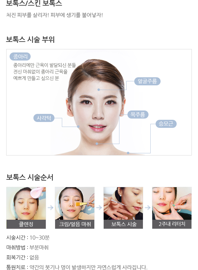 보톡스